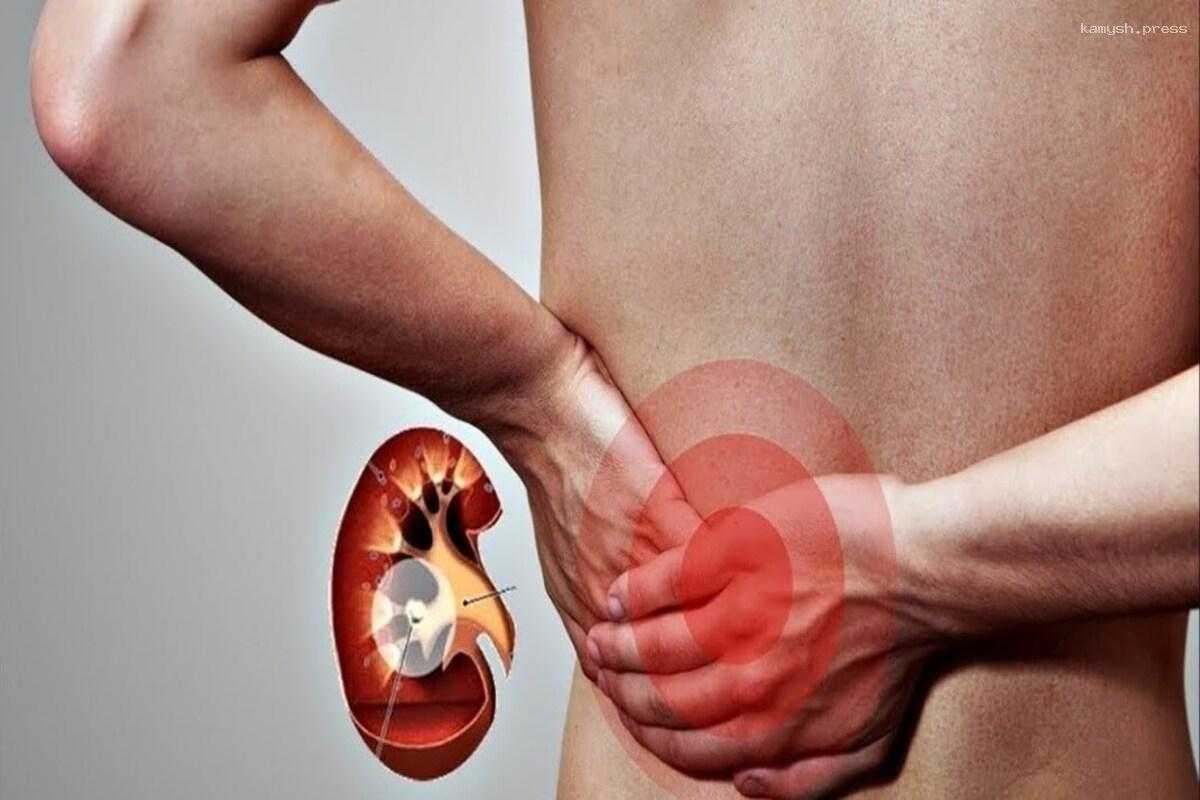 Сладкая еда является причиной обострения недугов мочевыводящих путей