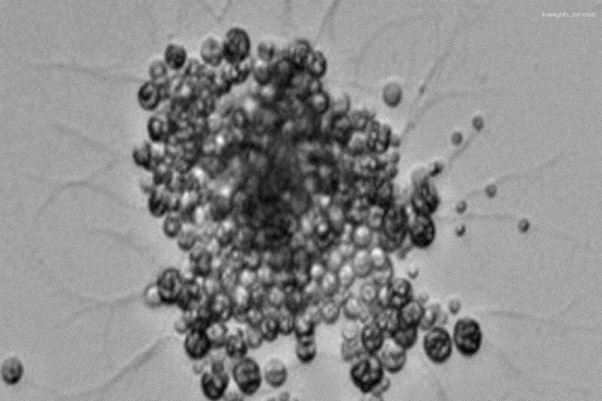 Российские ученые обнаружили в Черном море неизвестный науке микроорганизм