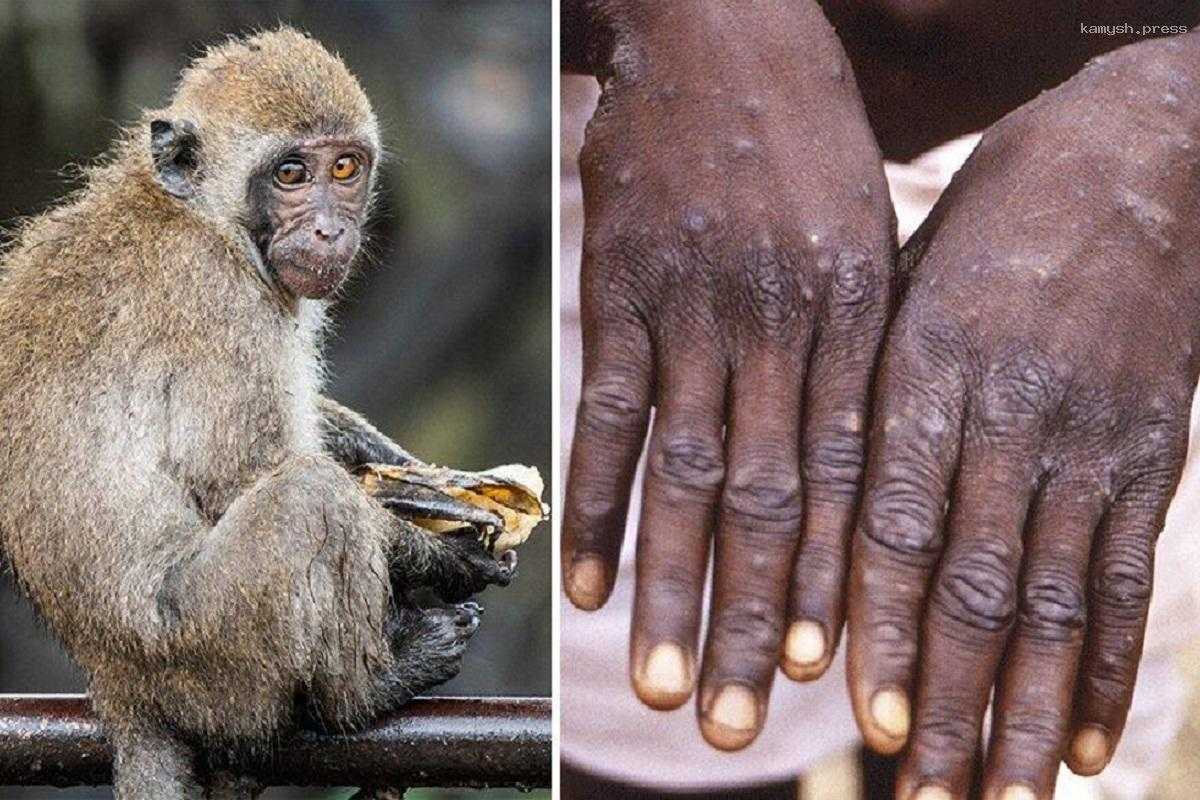 Еще три человека заразились в Камбодже вирусом оспы обезьян