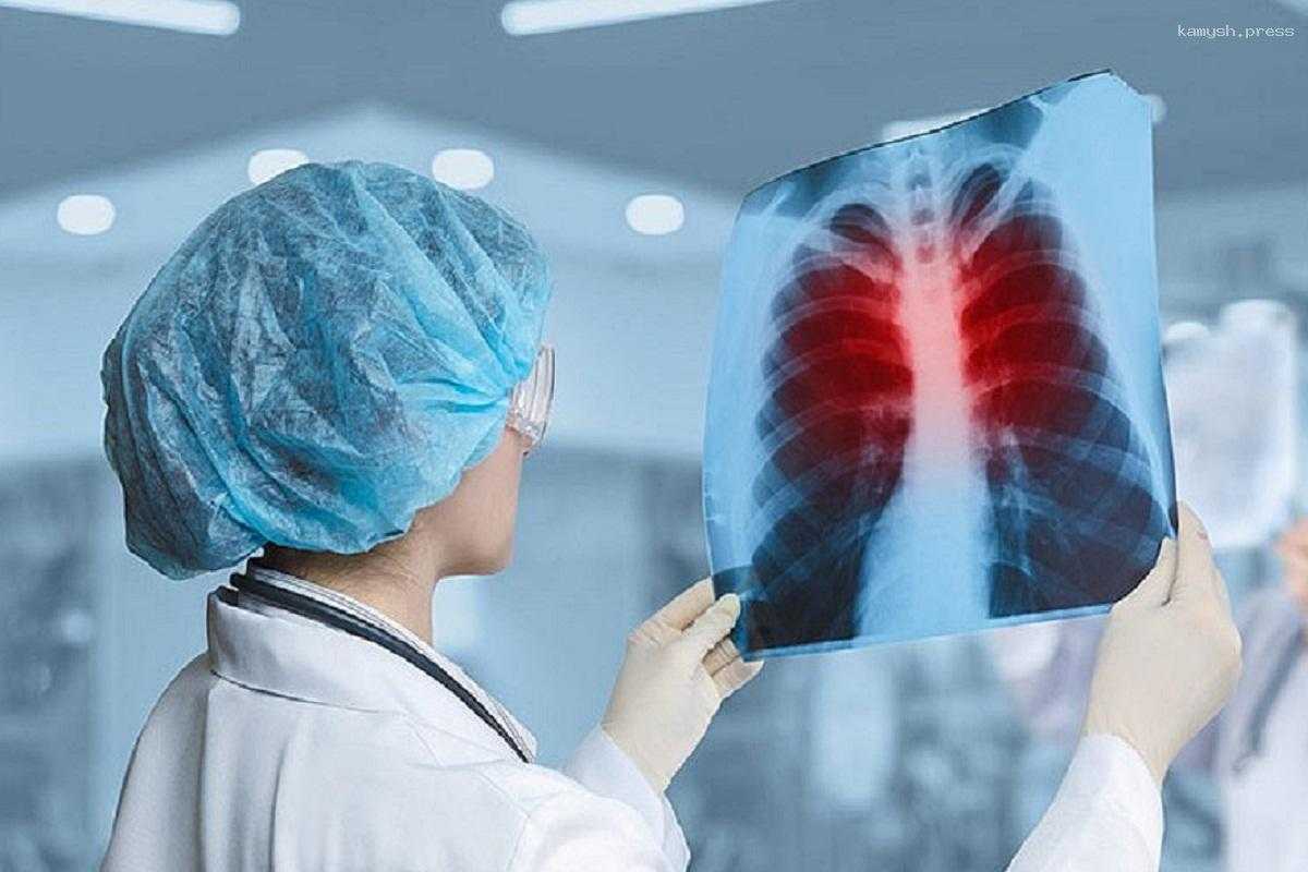 Пульмонолог Стружко рассказала о связи алкоголизма и туберкулеза