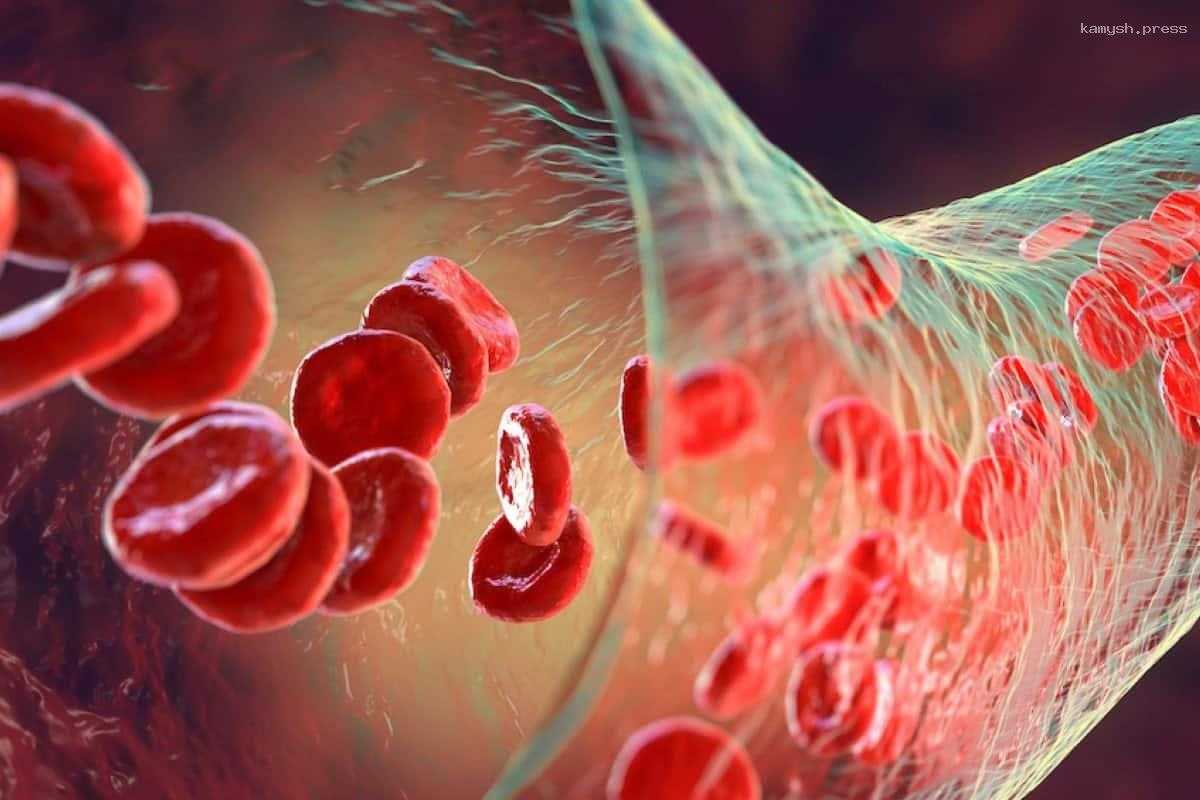 В Бурятии 60 детей болеют гемофилией и болезнью Виллебранда