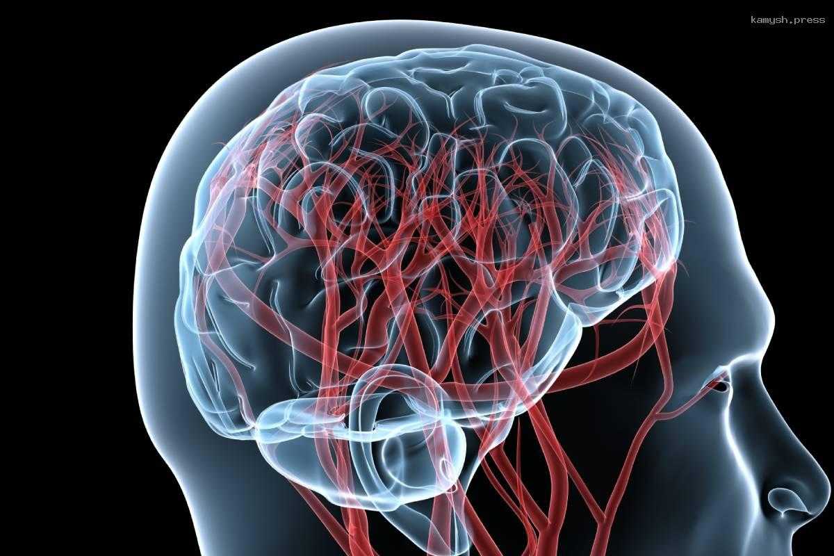 Стало известно, что ожирение ускоряет старение мозга