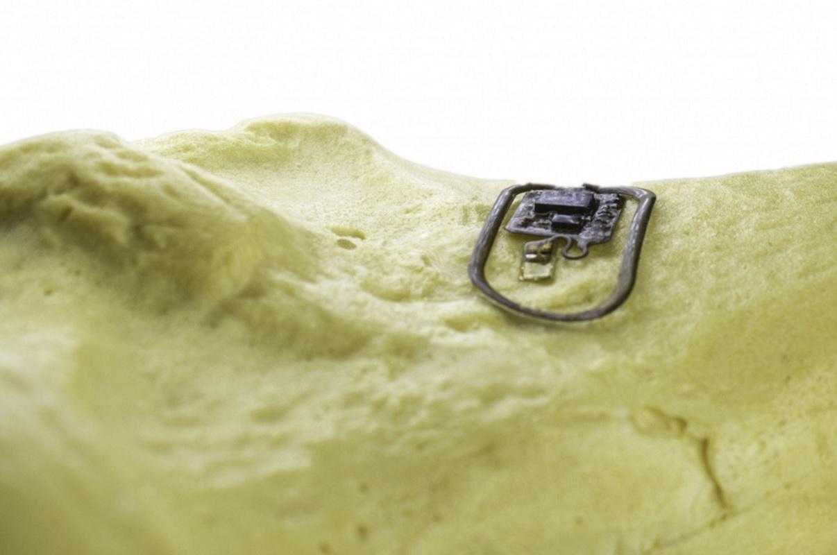 Создан метод сращивания костей и хрящей за счет активации стволовых при помощи наносиликатов