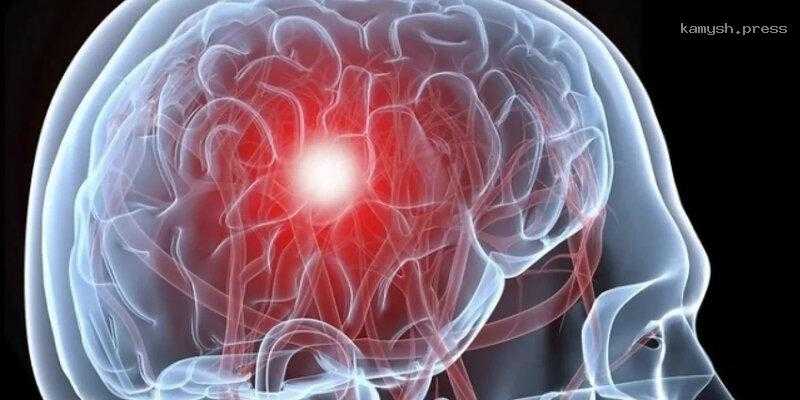 Ученые МТЦ СО РАН провели исследования динамики восстановления кровотока в мозге после инсульта