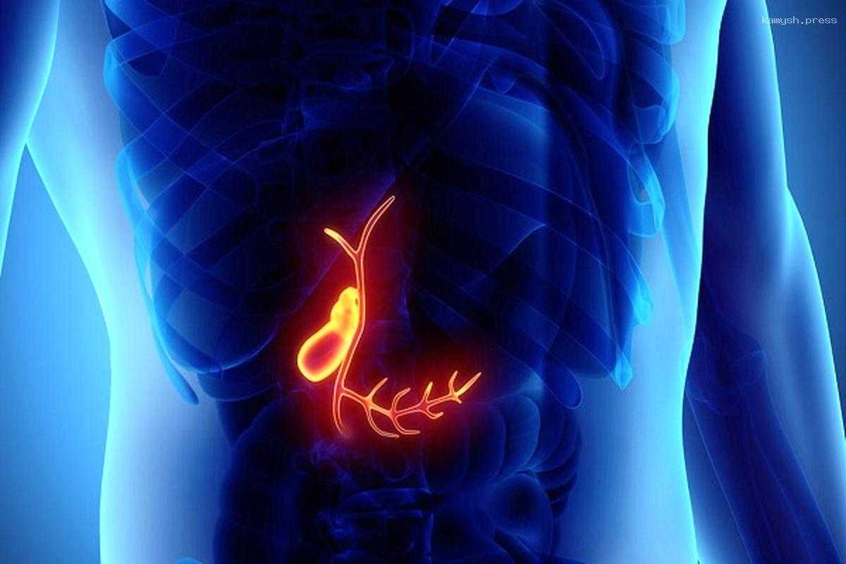 Названы главные причины камней в желчном пузыре