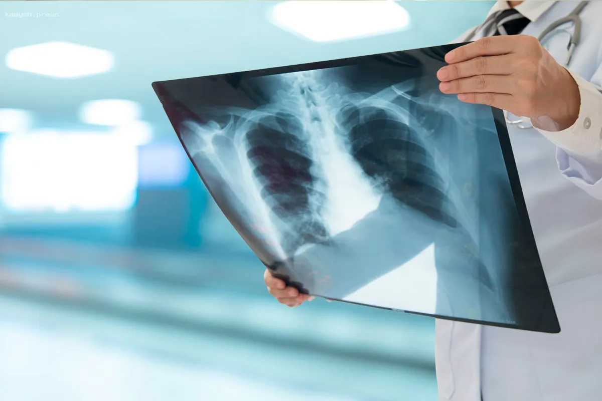 Пульмонолог объясняет, возможно ли полностью излечиться от туберкулеза