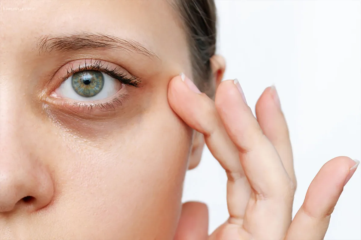 Косметолог поделилась советами по устранению темных кругов под глазами в домашних условиях