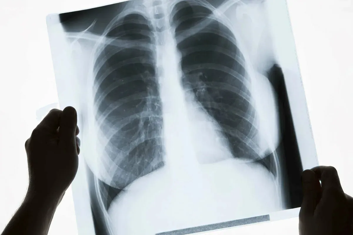 В Санкт-Петербурге запустили передвижной флюорографический кабинет