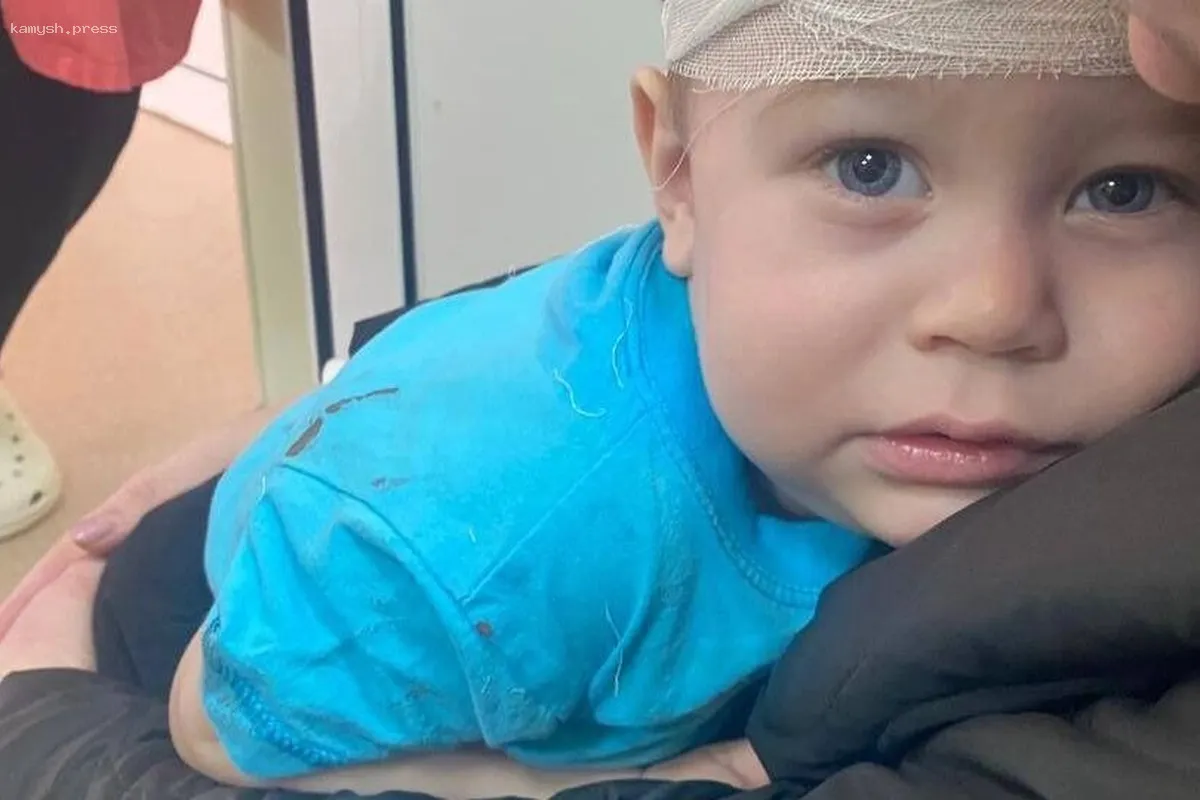 В Тюмени отец малолетнего сына намерен подать иск к детскому саду из-за травмы ребенка