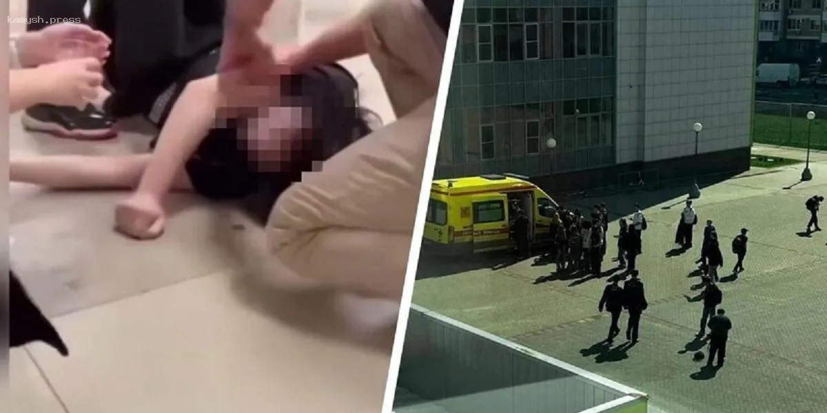 Травма челюсти: группа подростков напала на школьника в Москве из-за его внешности